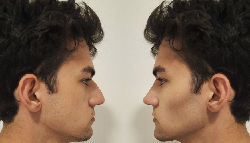 transformation side.png