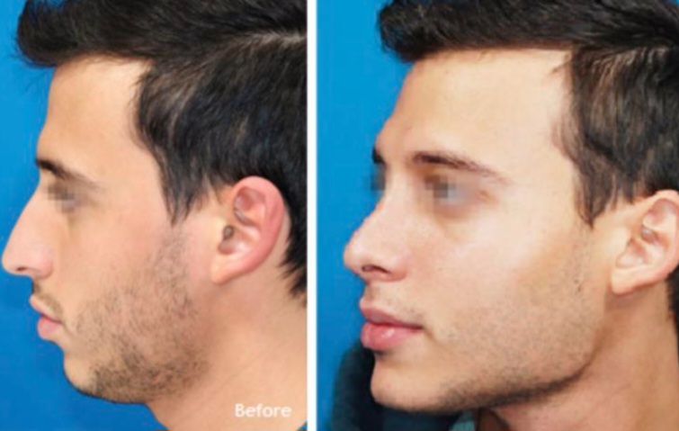 Screenshot 20251101 231925 Chrome