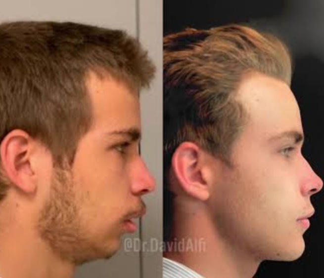 Screenshot 20251101 231900 Chrome