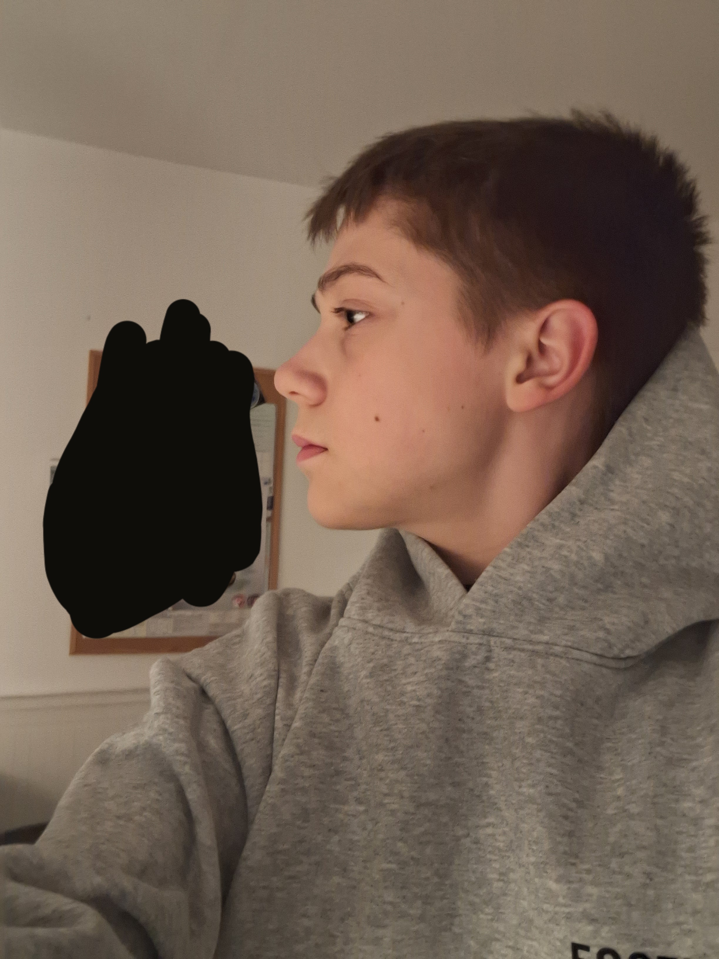 1000015581