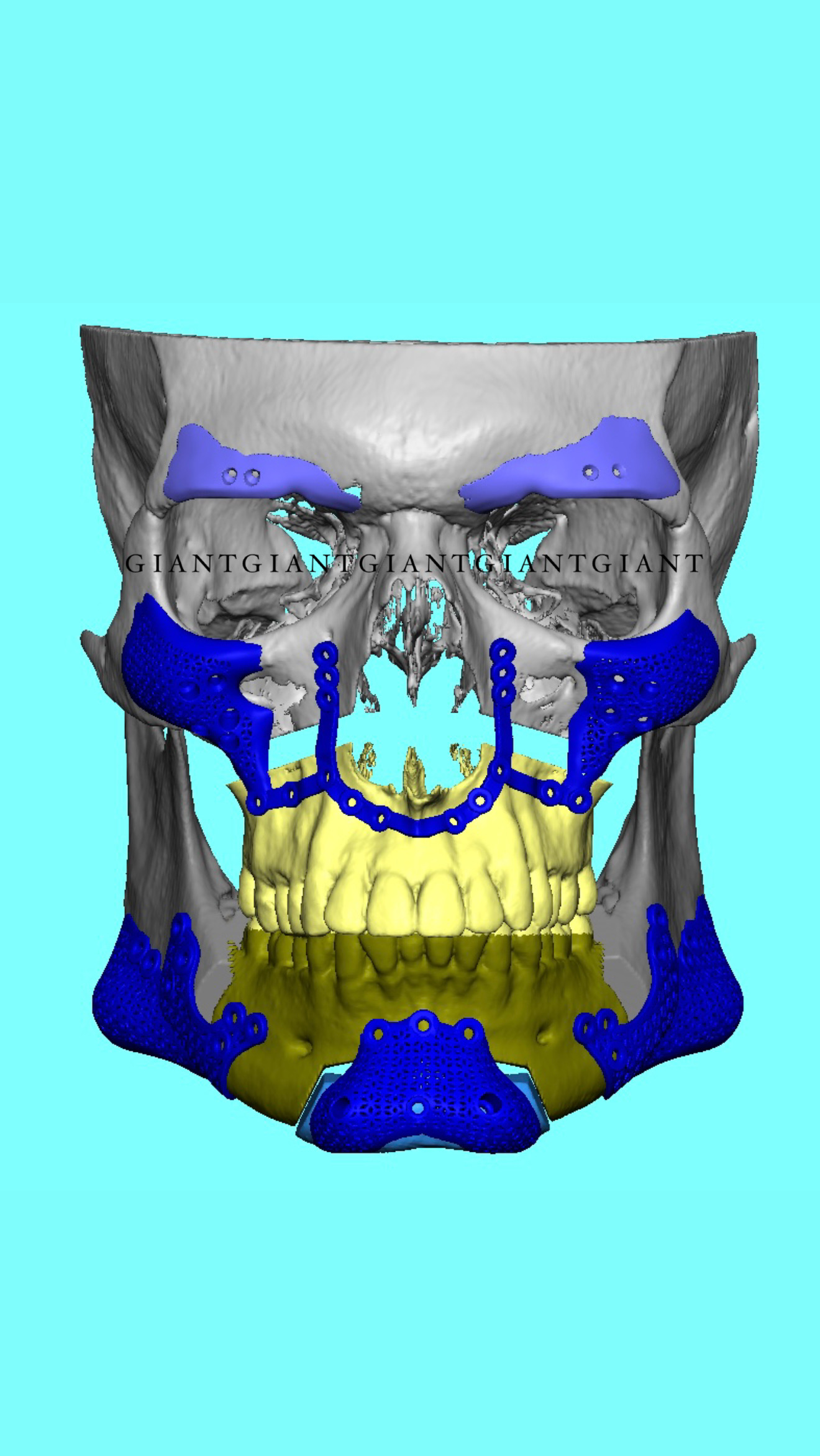 1FF02546 3DCE 43C6 87F5 96C1B5B2F146