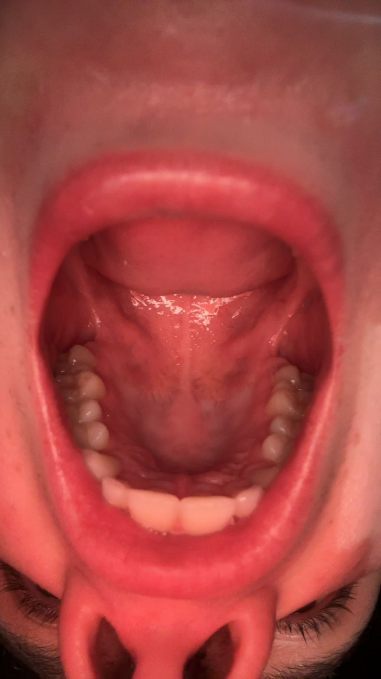 IMG 3700