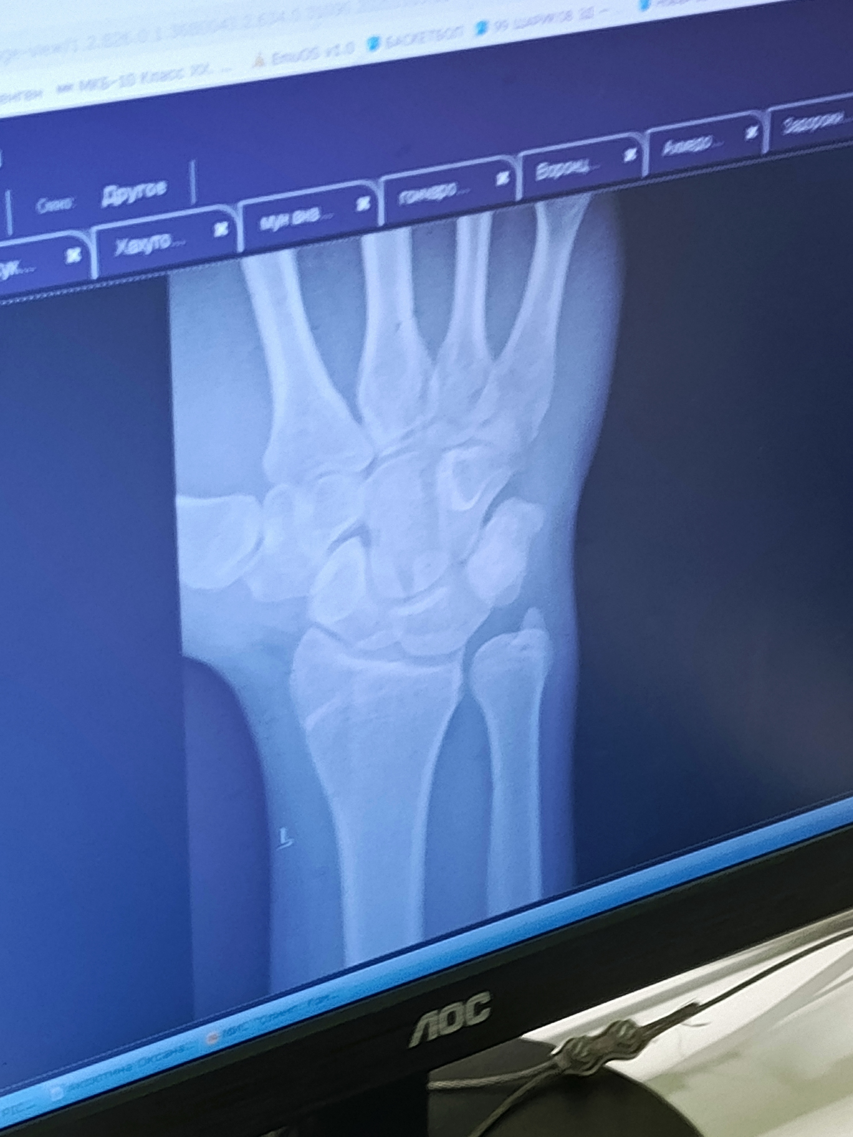 IMG 20251105 115643 962