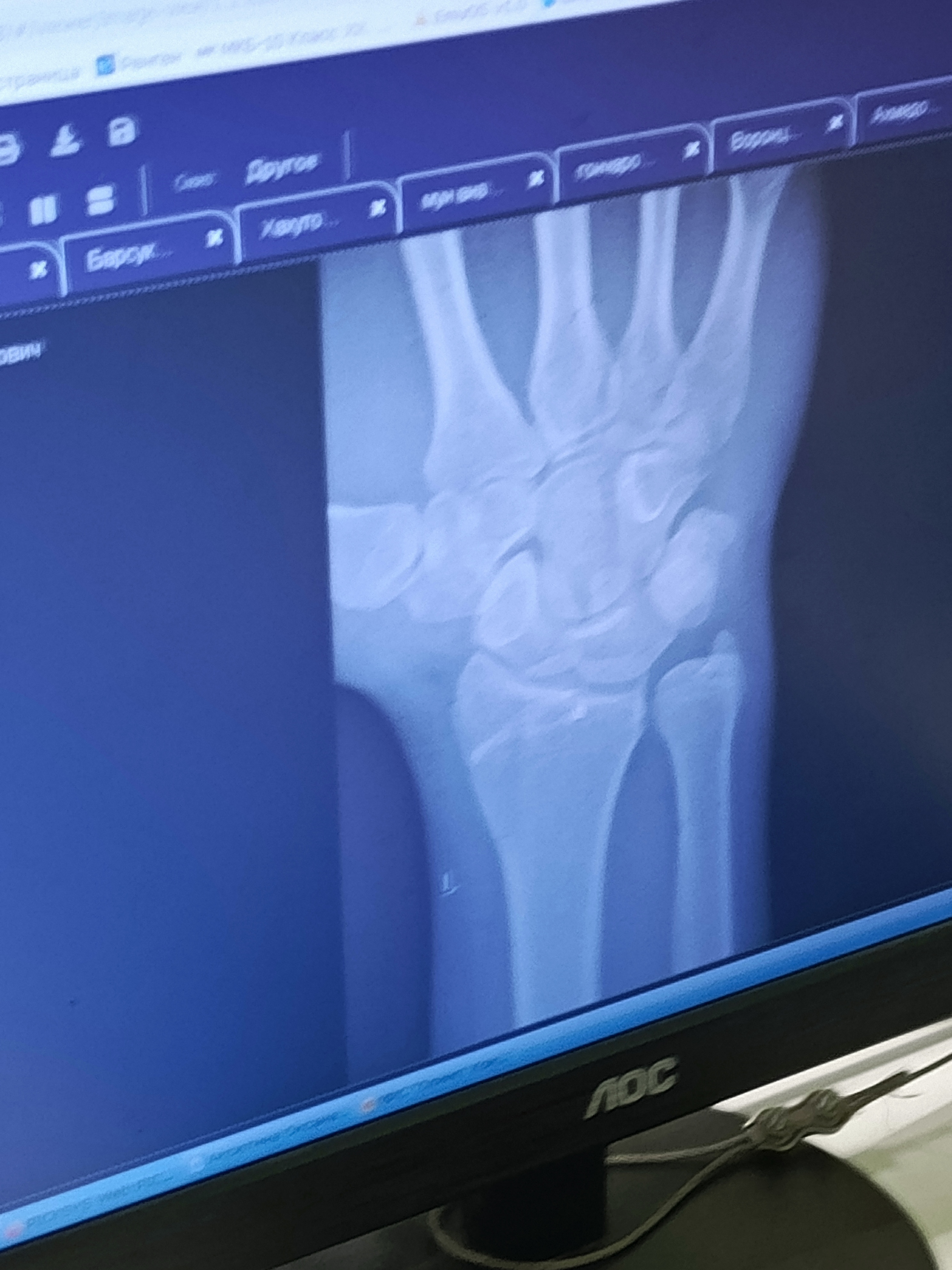 IMG 20251105 115642 316