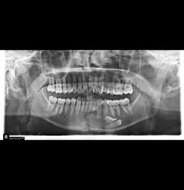 365e18de 148a 4fd2 baf4 ad7544f03048