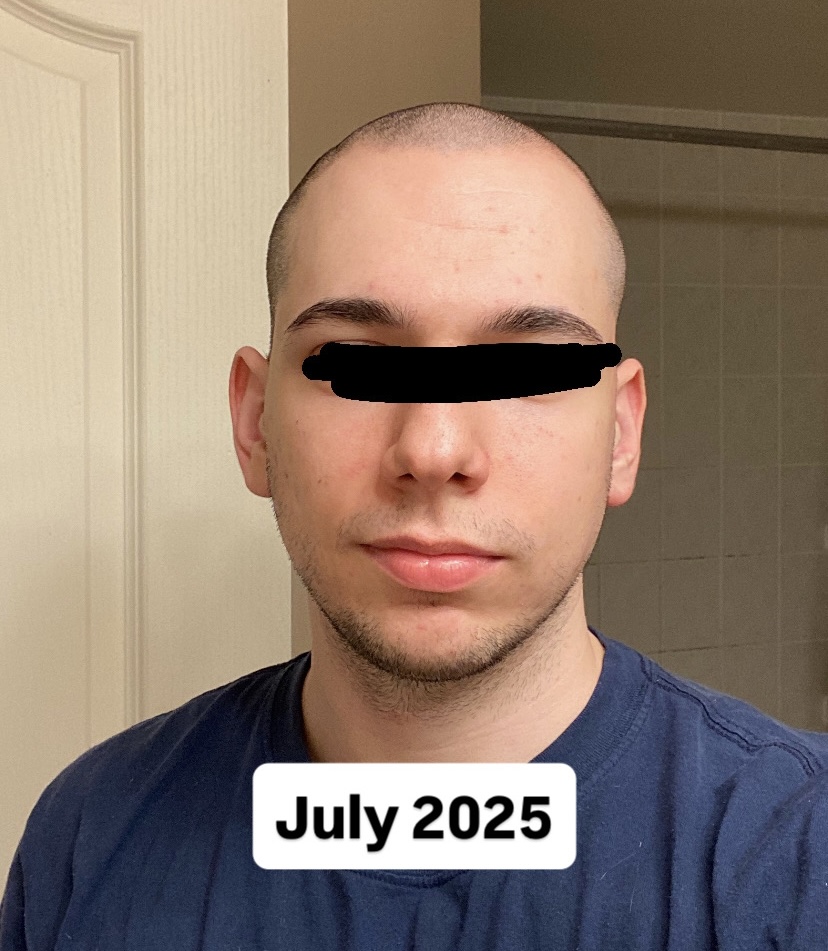 11AA1C0C B072 4706 980D BB0D330401BF