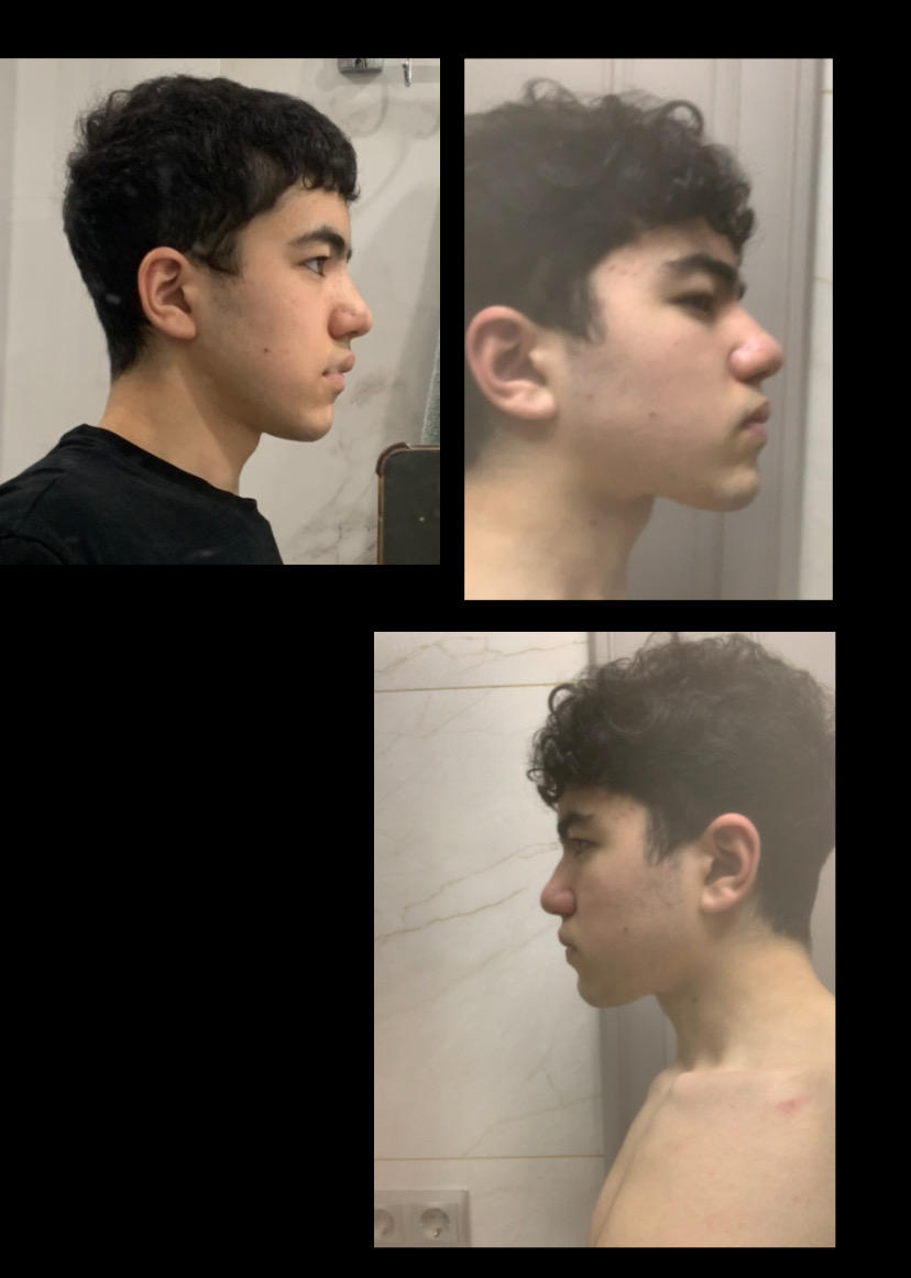 1462DB45 0306 4E3F 8D3F 757070CFF284