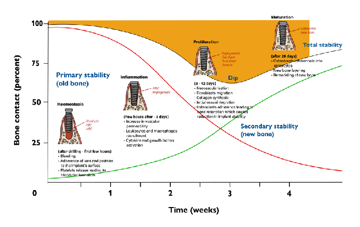 Stages of osseointegration and changes in implant stability with time