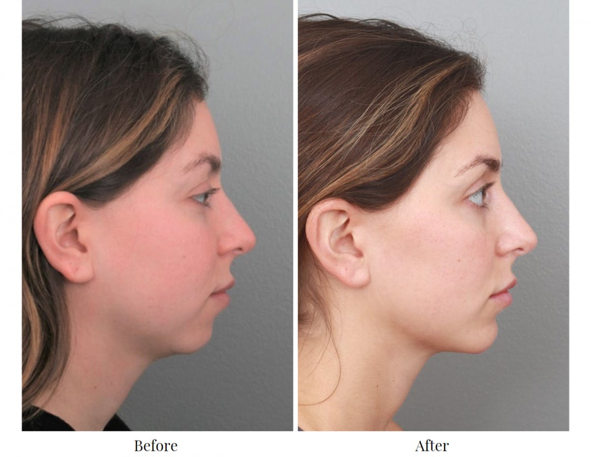 1678136304 profile right 1200x929