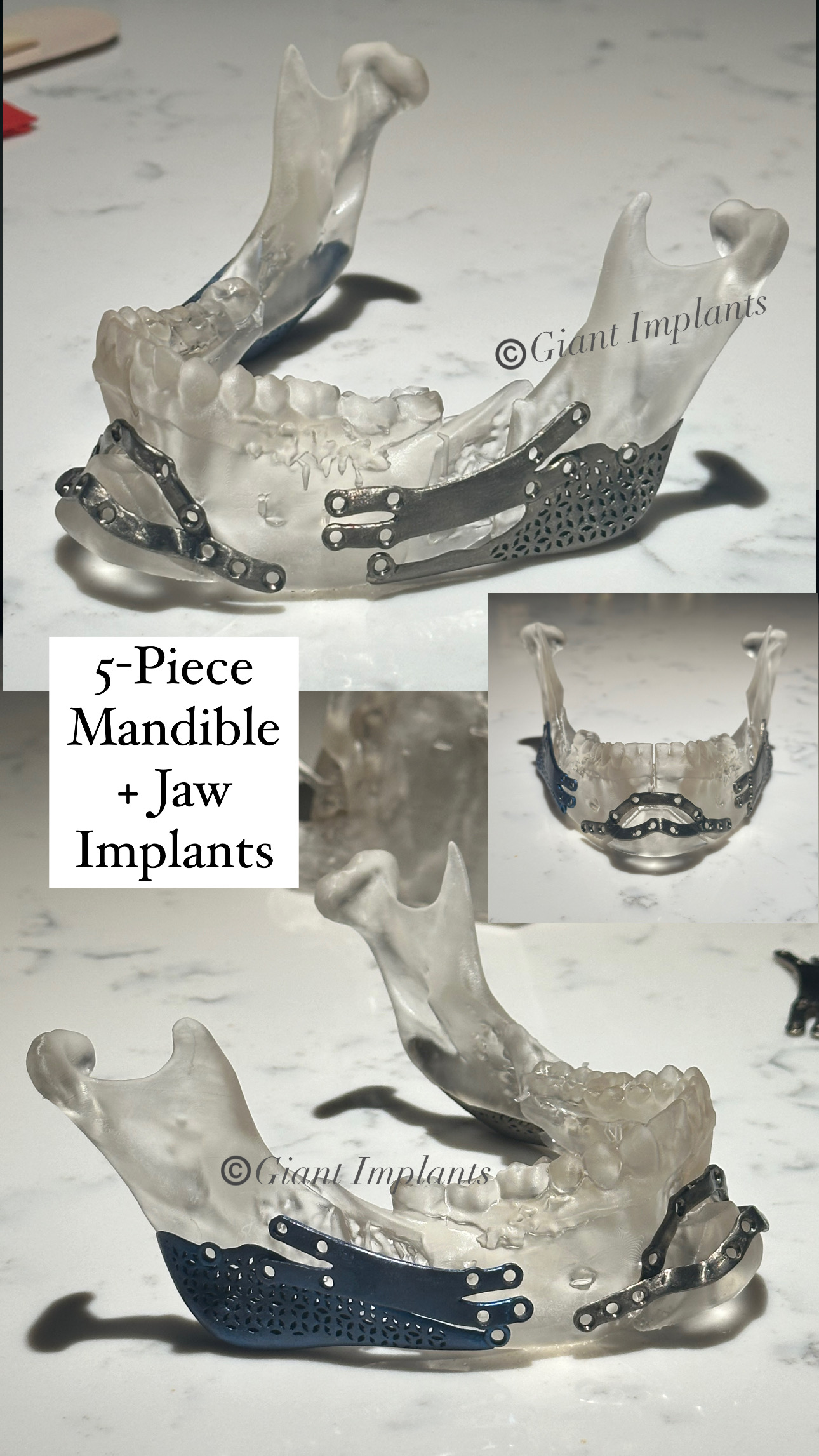 40B22D4C 5CCD 4366 835F 2AC7FBEA9F93