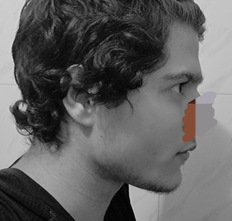 Retouch 2025111020432578