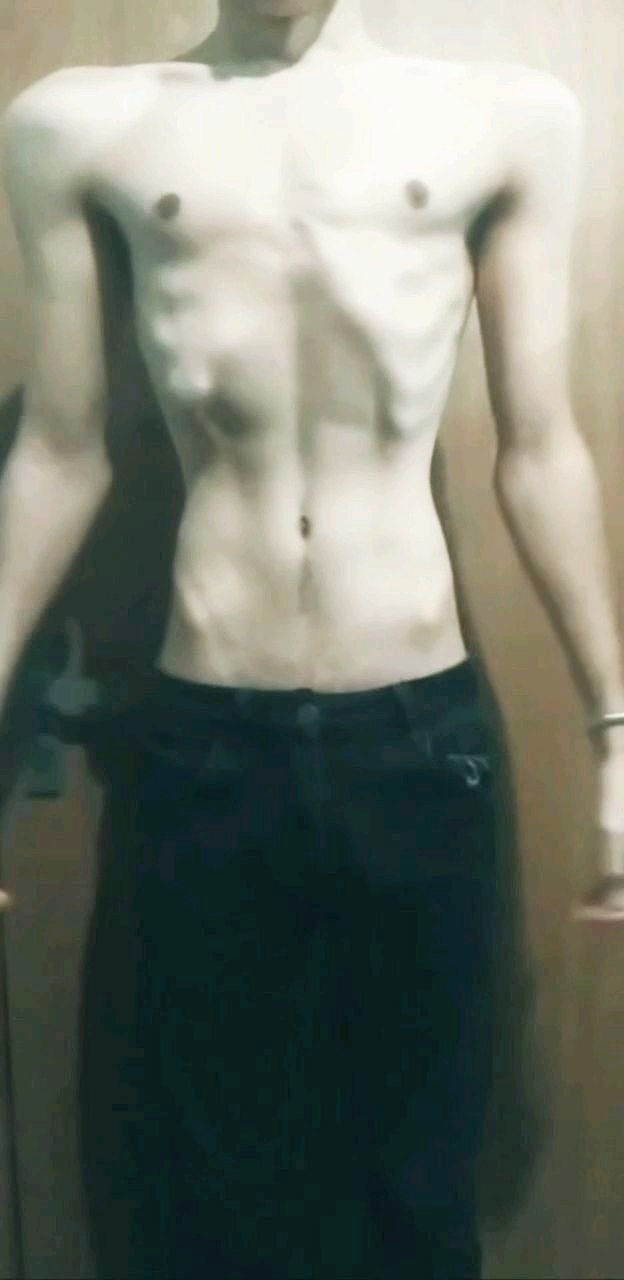 1000020109