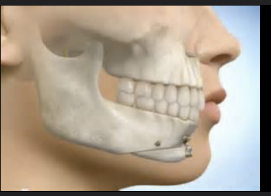 Screenshot 2025 11 10 at 83815PM