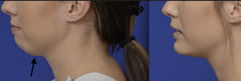 Screenshot 2025 11 10 at 85316PM