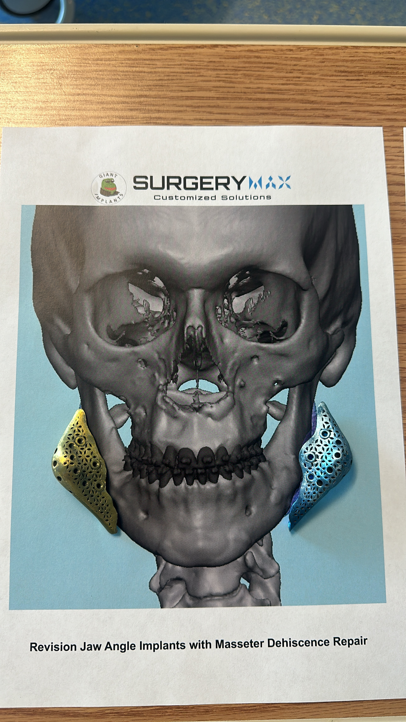 78D6F870 E064 457C 9C7F 8769C8E3C9C6