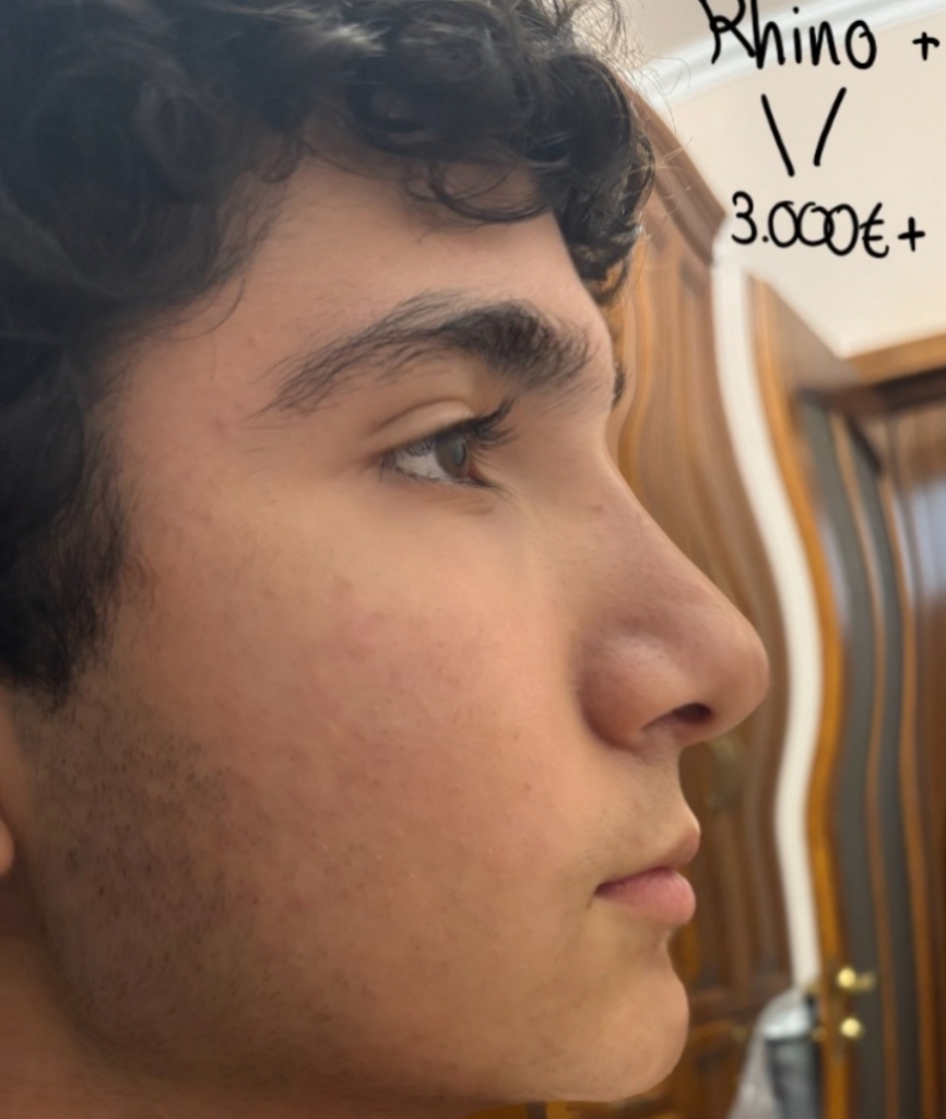 1000028289