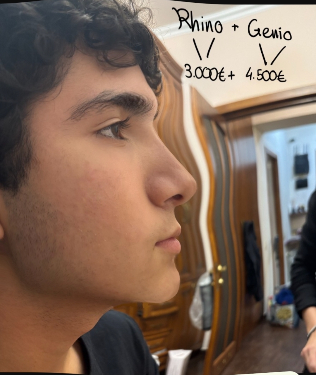 1000028293
