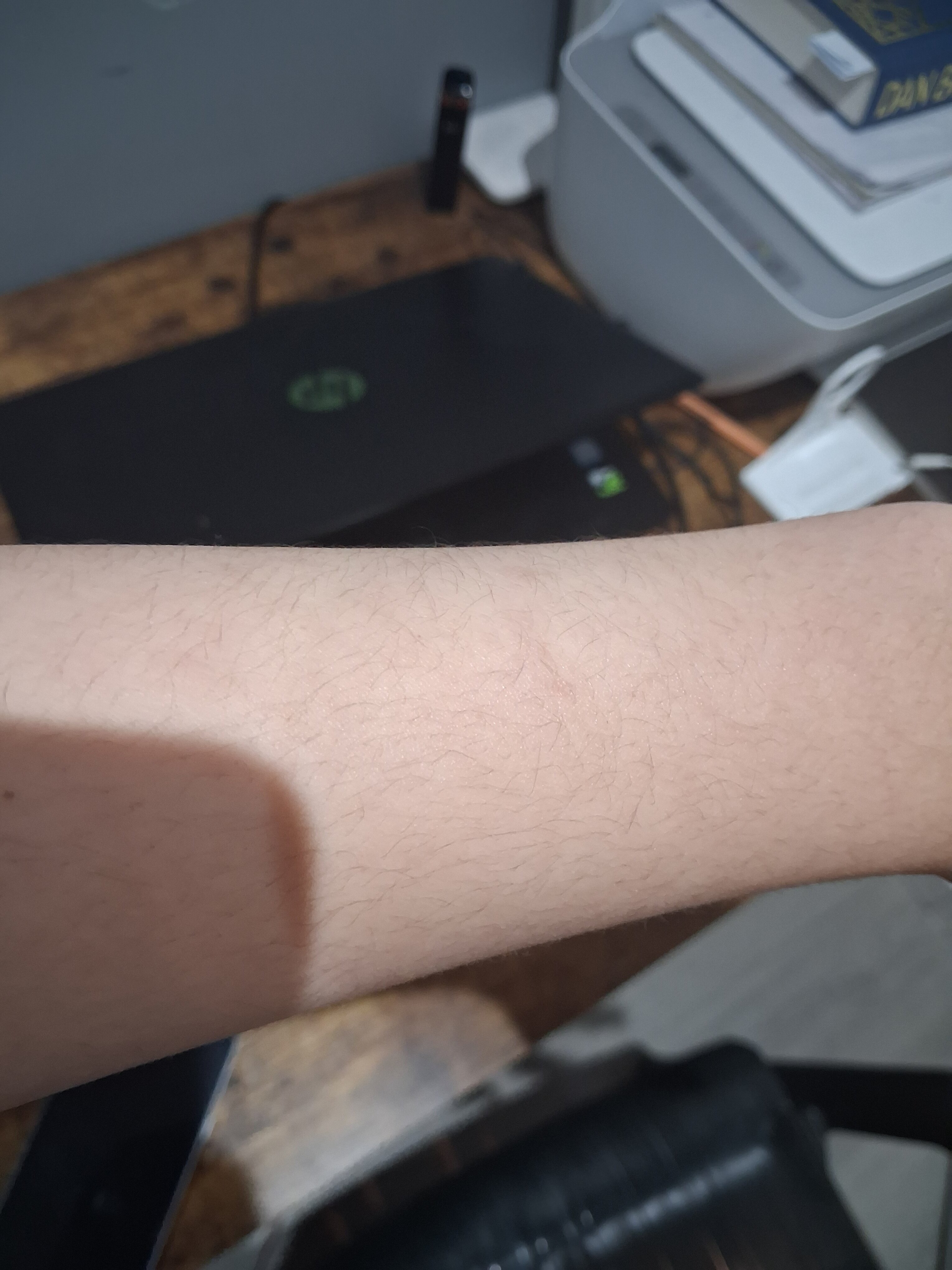 17629830571891319662404324249912