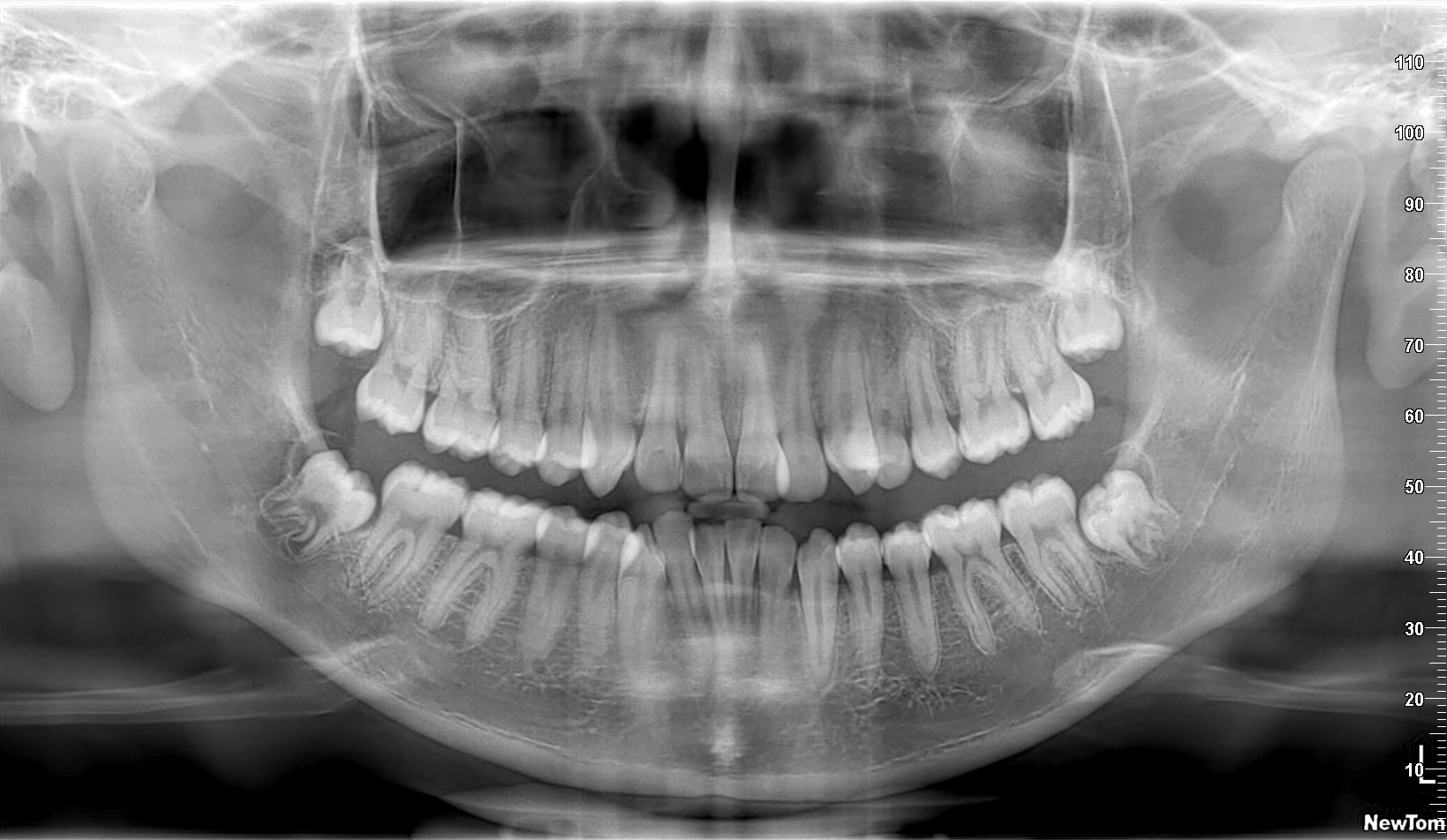 Tenezaca Guaman Geovany Patricio 2009 11 07 PAN05 4
