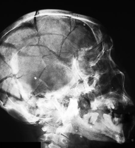 Istockphoto 469786620 612x612