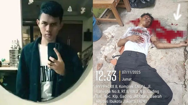 1000148741