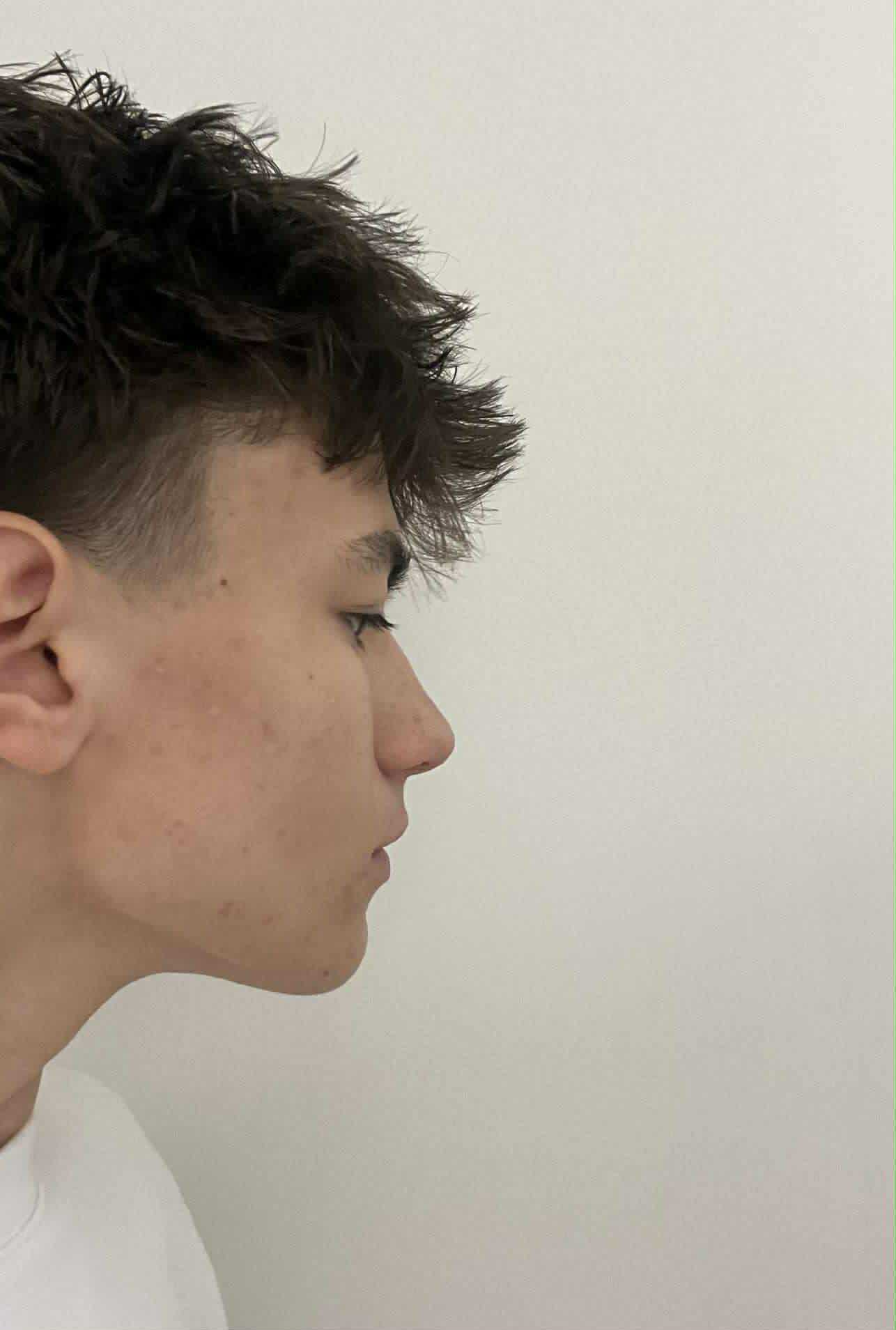 Side