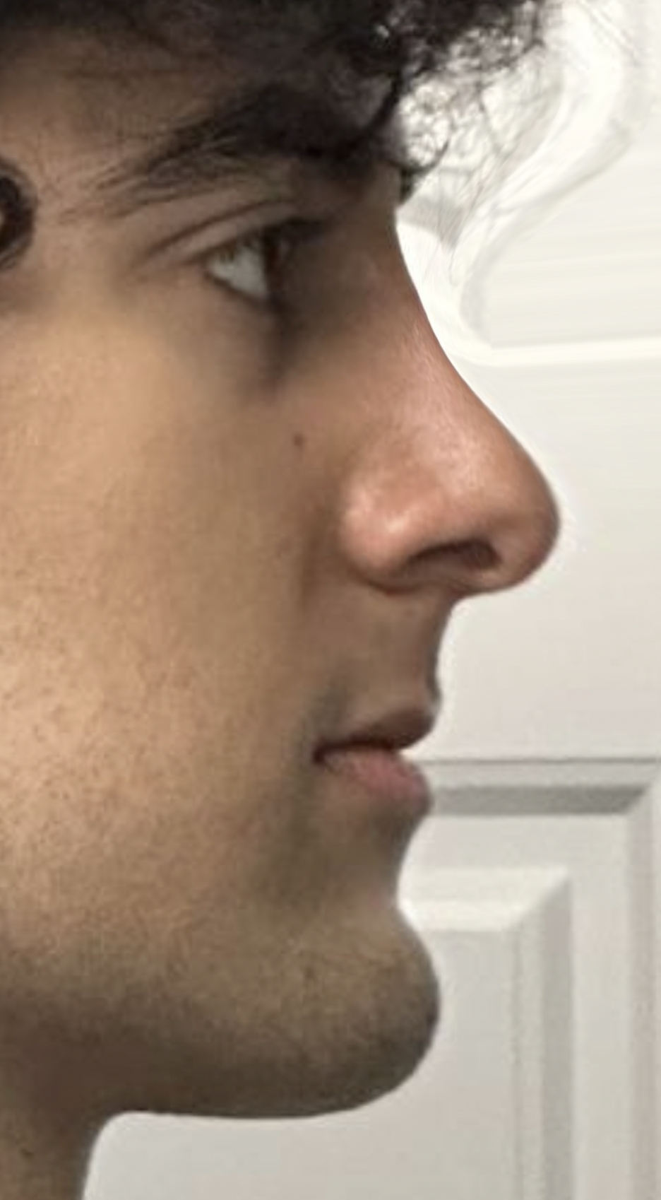 Retouch 2025111807595538