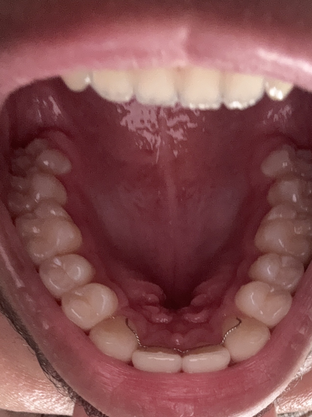 IMG 5A779044 AEC7 4662 BDD5 F79B6E612257