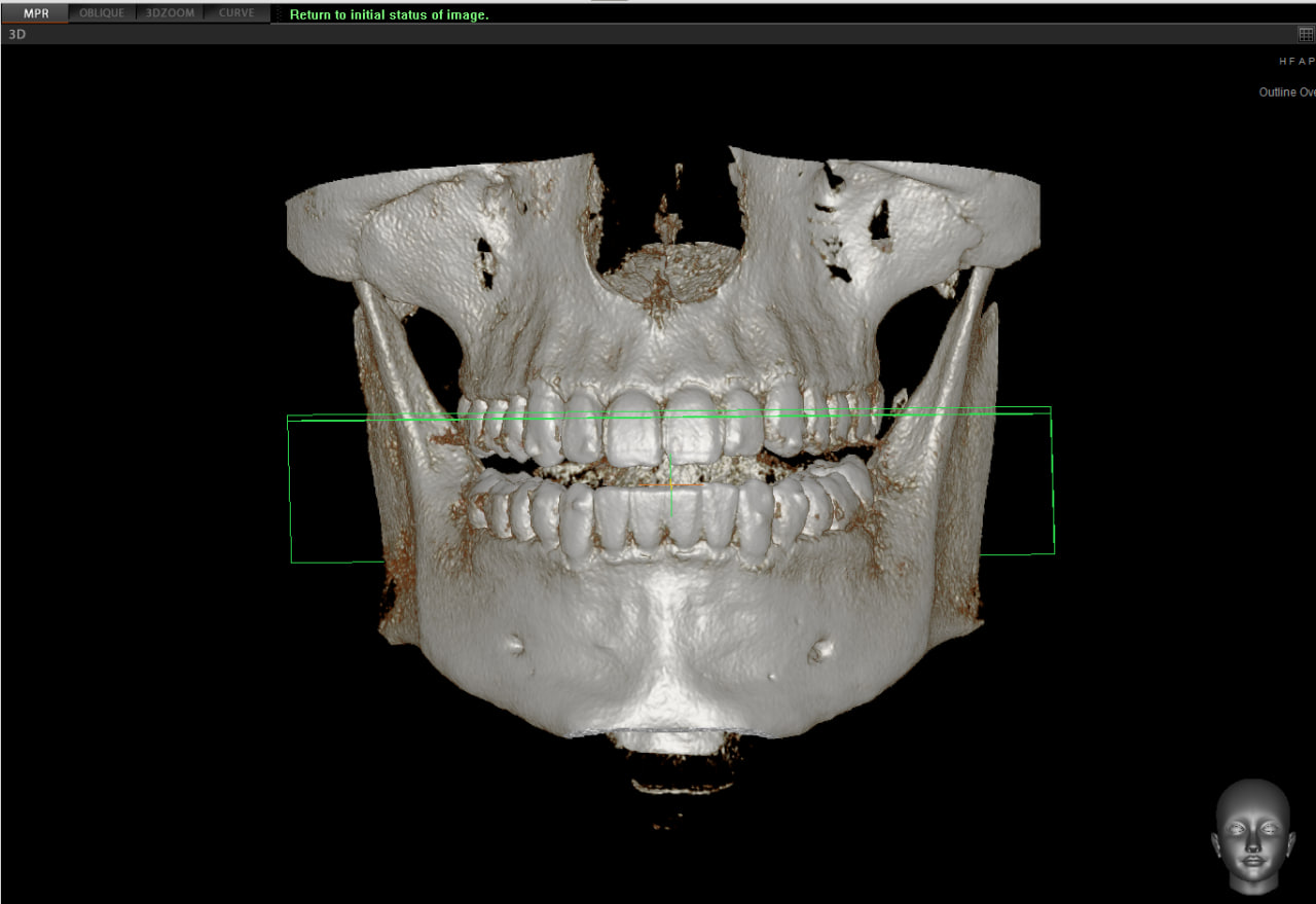 Photo 2025 11 20 00 20 25