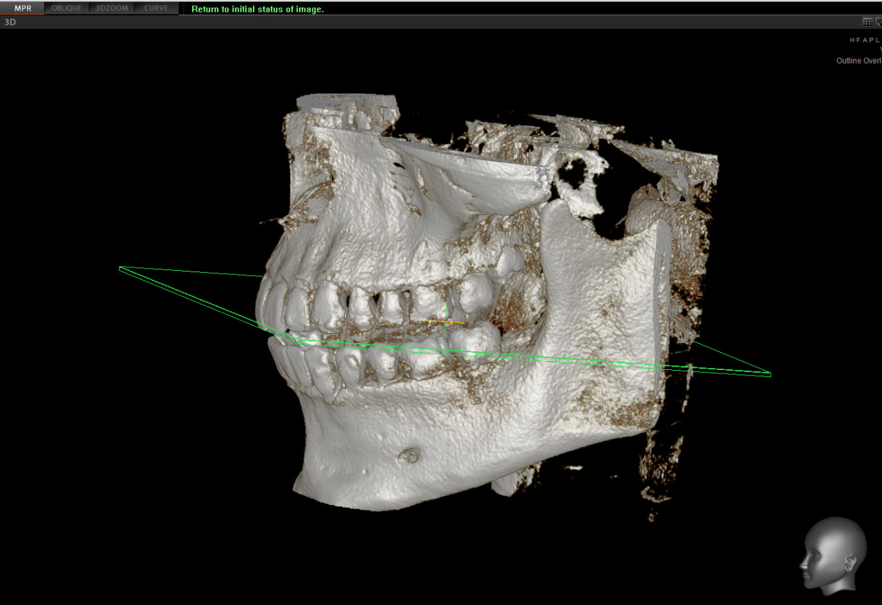 Photo 2025 11 20 00 20 28