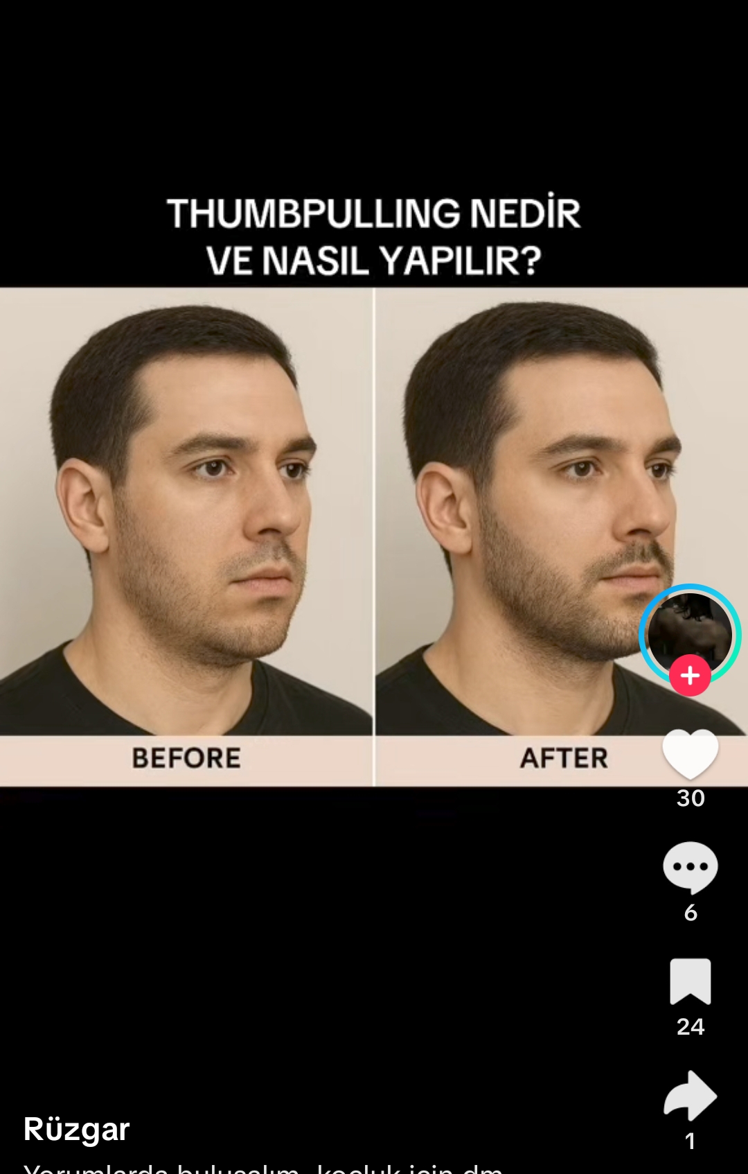 Screenshot 2025 11 21 20 05 48 660 comzhiliaoappmusically edit