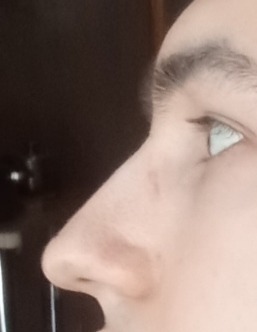 1000059483