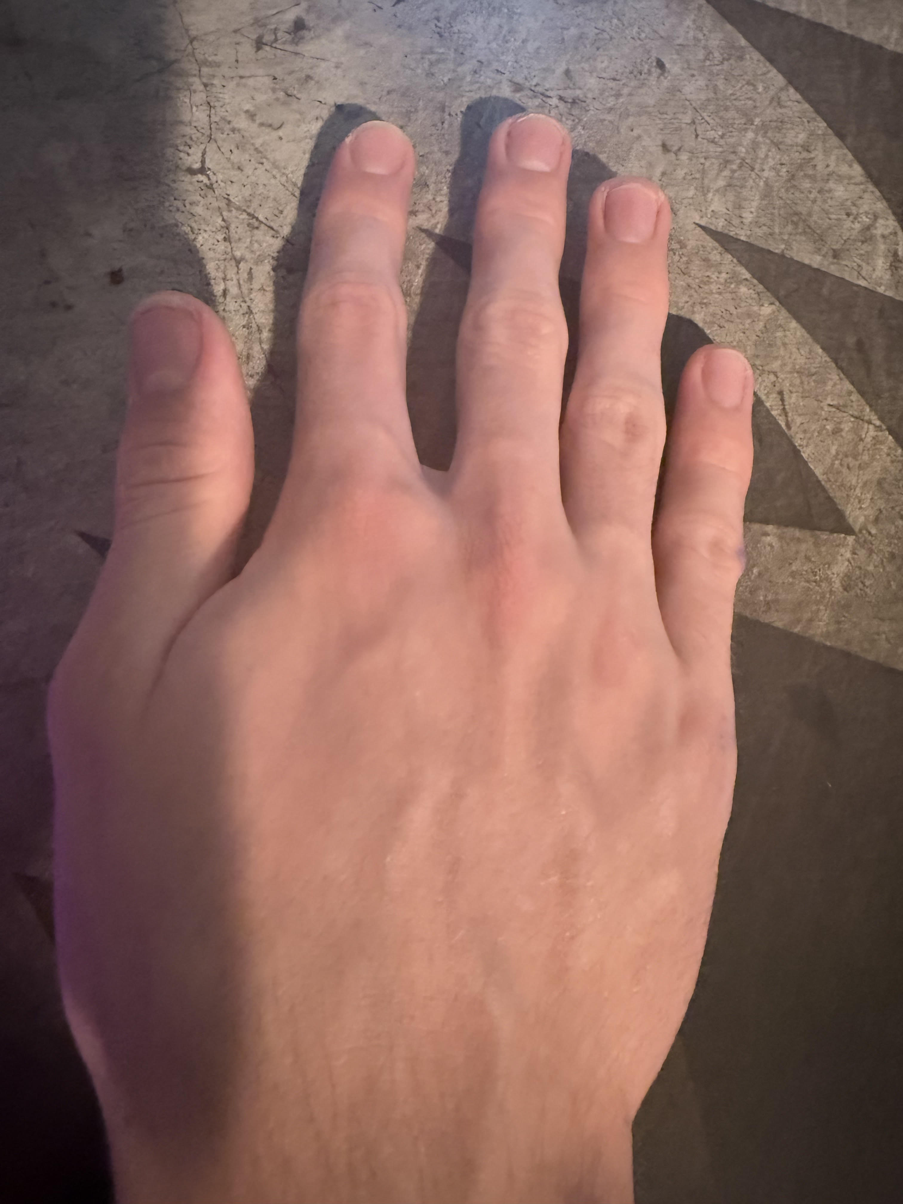 Hand