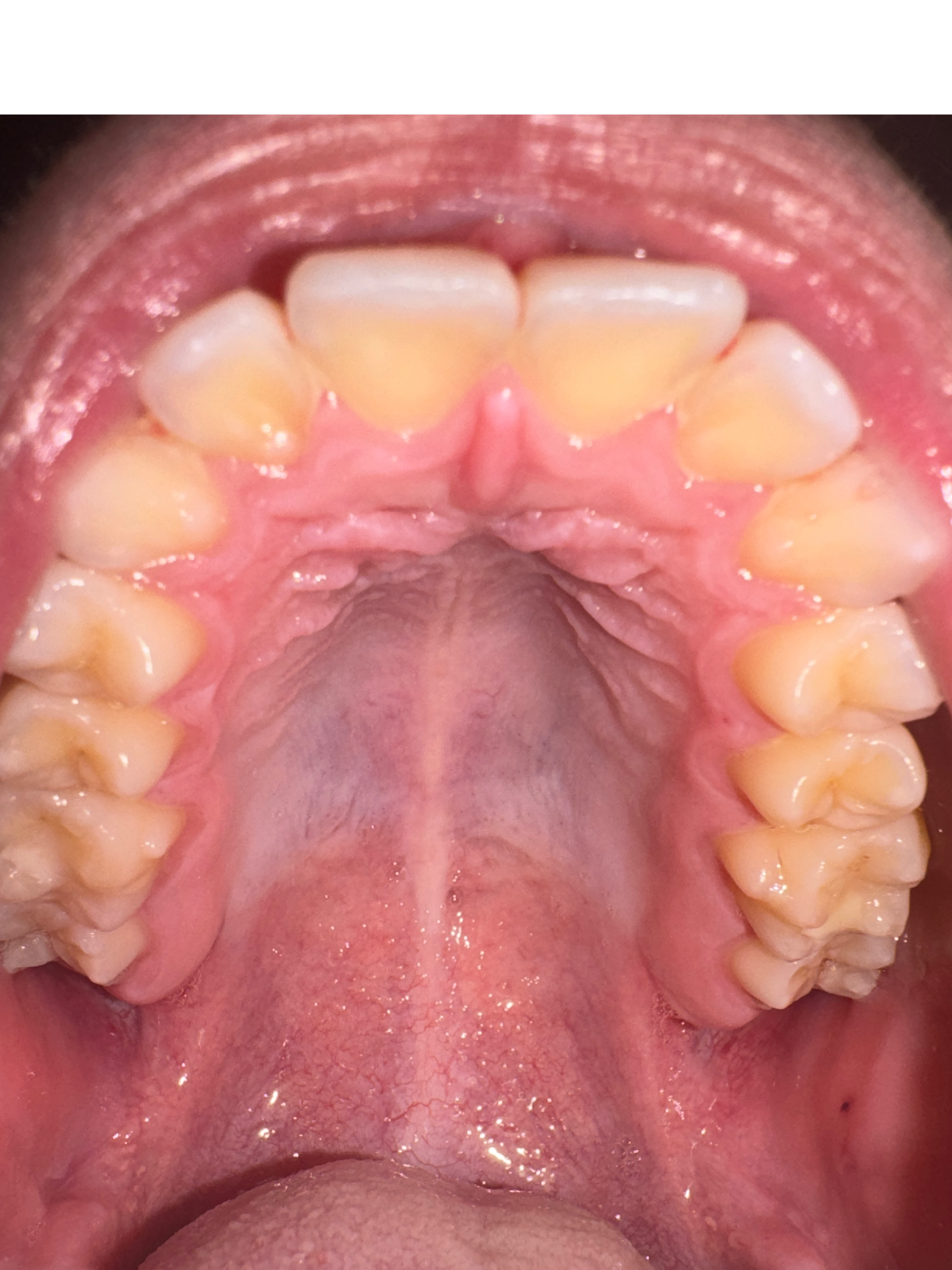 Untitled1170 20251129010500