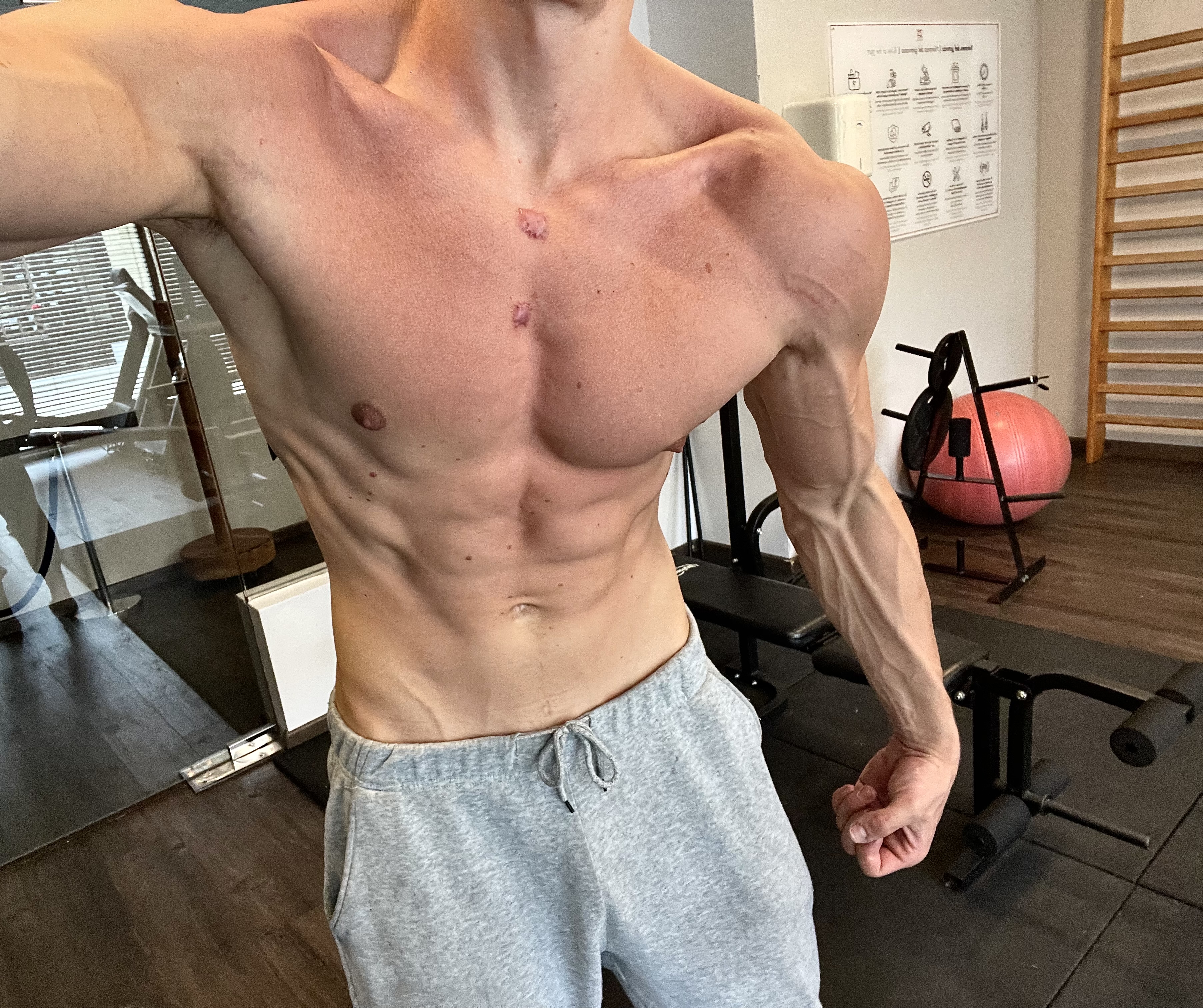 IMG 0685