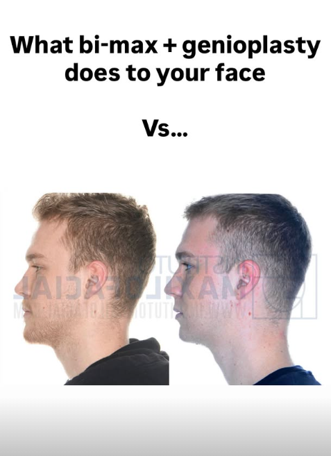 JESTER PATELM 55.png