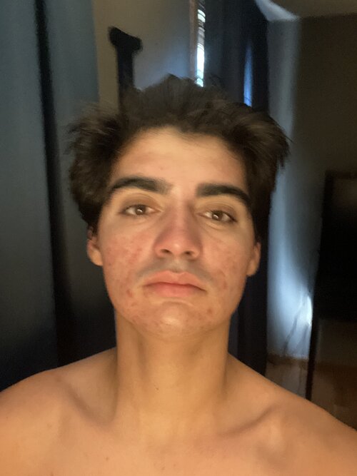 RenderedImage.jpeg