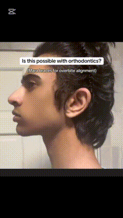 copy_457F4825-047B-492C-BD81-62606E339E5F.gif