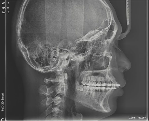 Screenshot 2025-11-06 233621.png