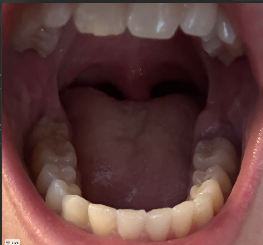 Screenshot 2025-11-18 at 11.03.20 AM.png