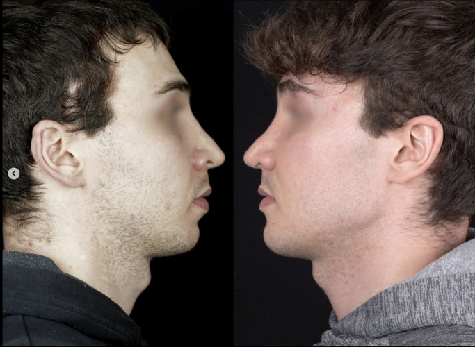 Screenshot 2025-11-20 at 8.48.24 PM.png