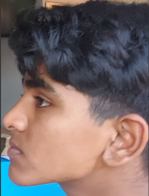 Side Profile Blue Background.png