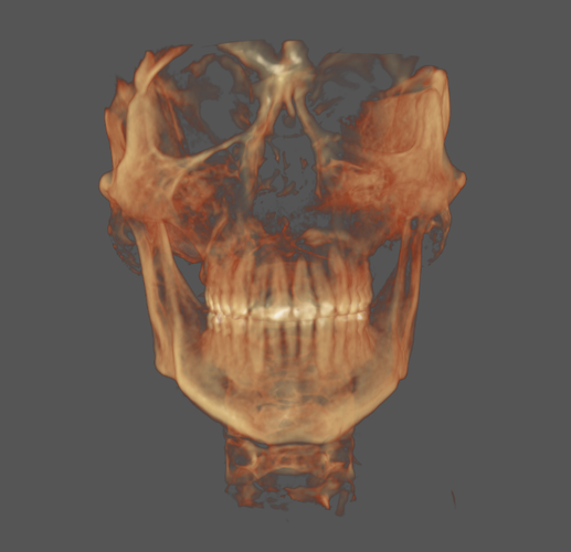 Skull 3.png