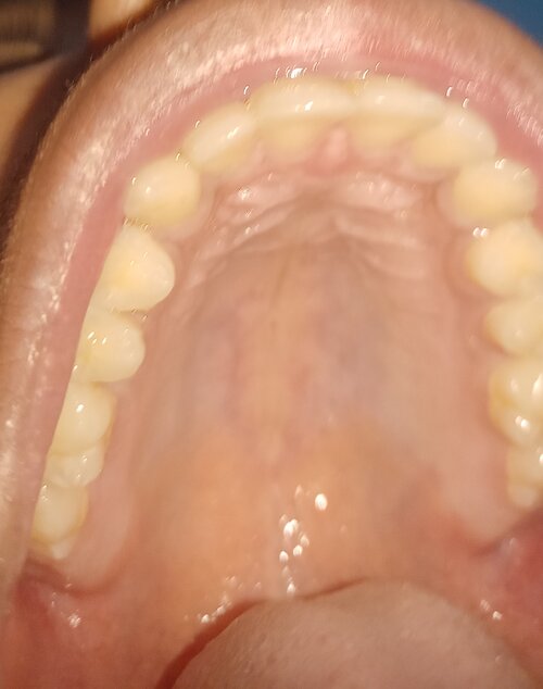 IMG 20251129 203821