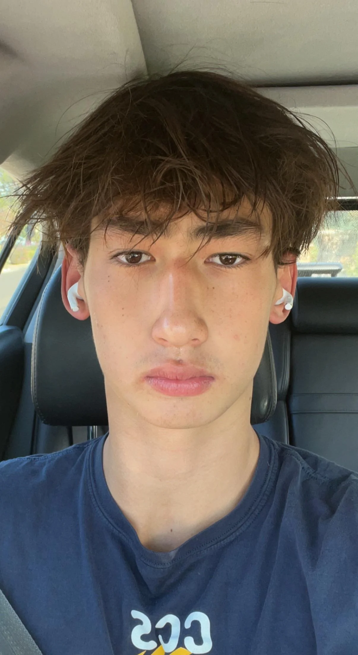 Midface