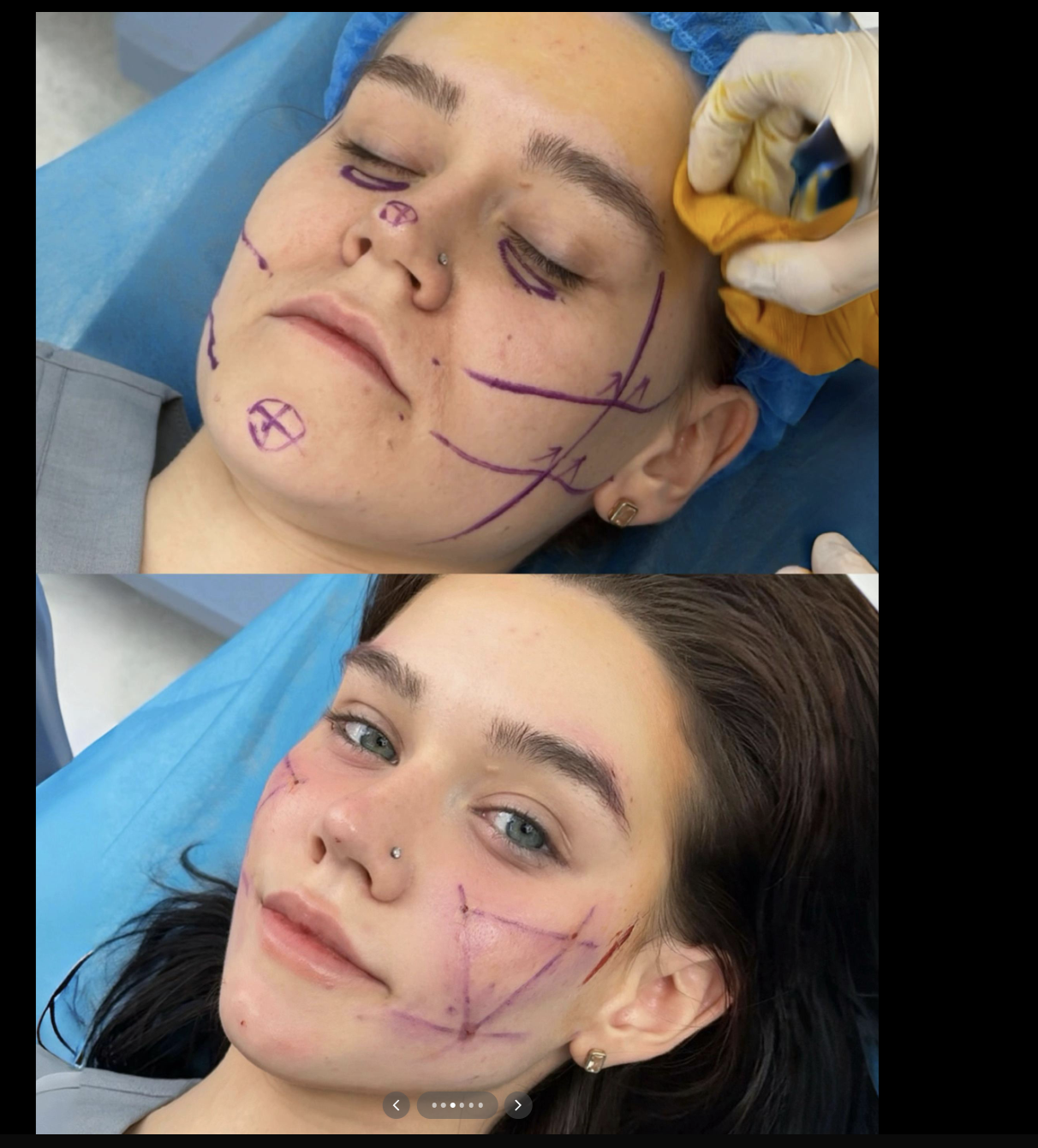 5608617 1764683574822