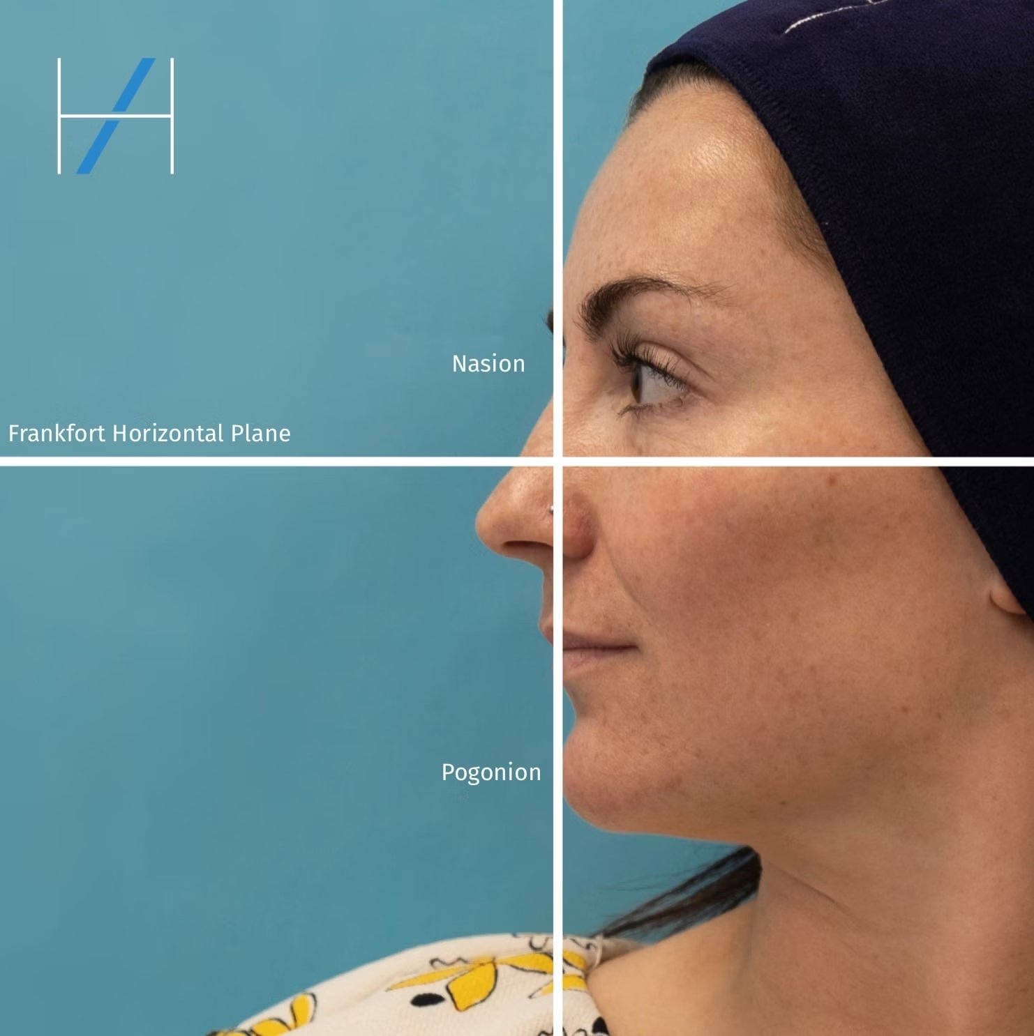 ZhJ0UxrFxhpPBWp  IMG 5770