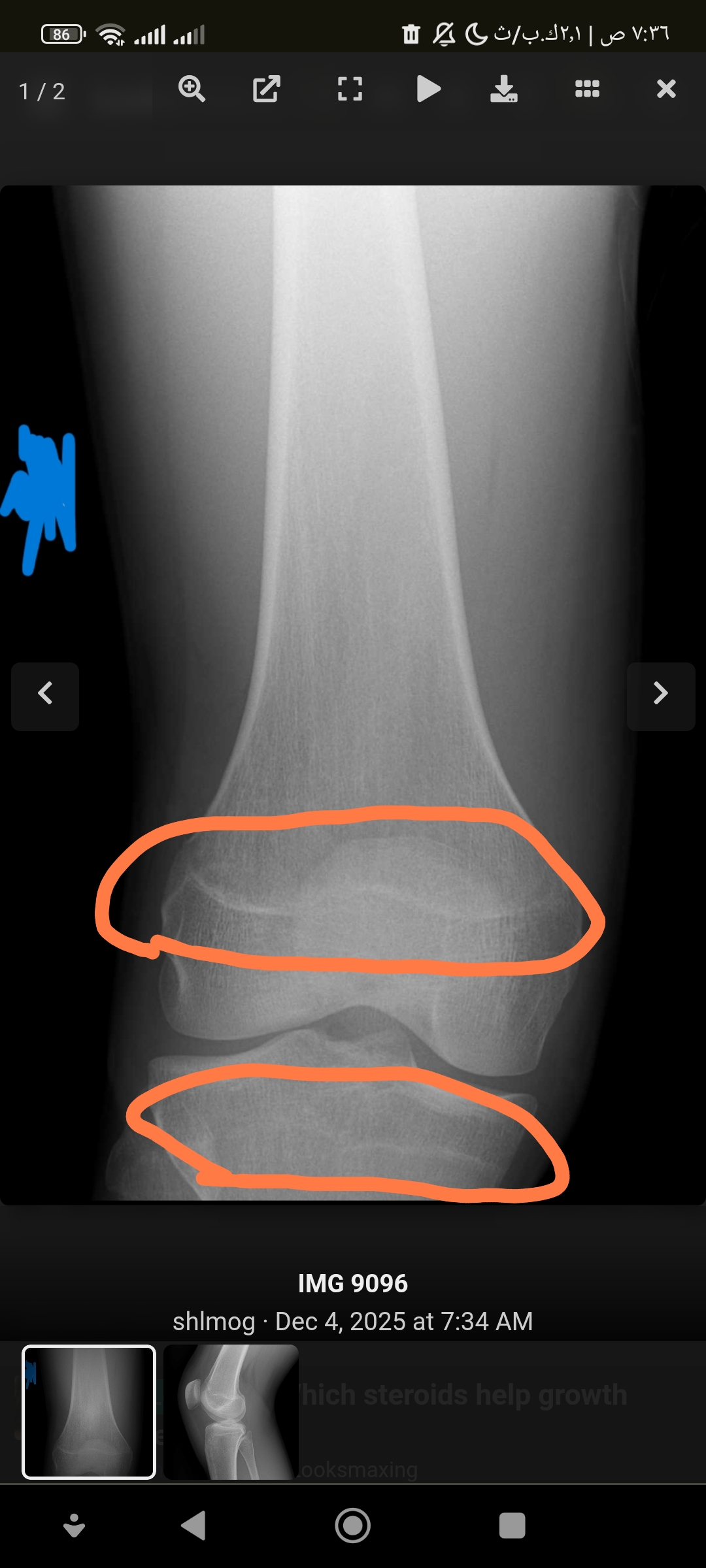 Screenshot        edit comandroidchrome