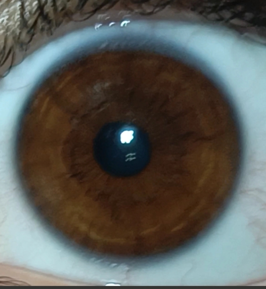 1000029033
