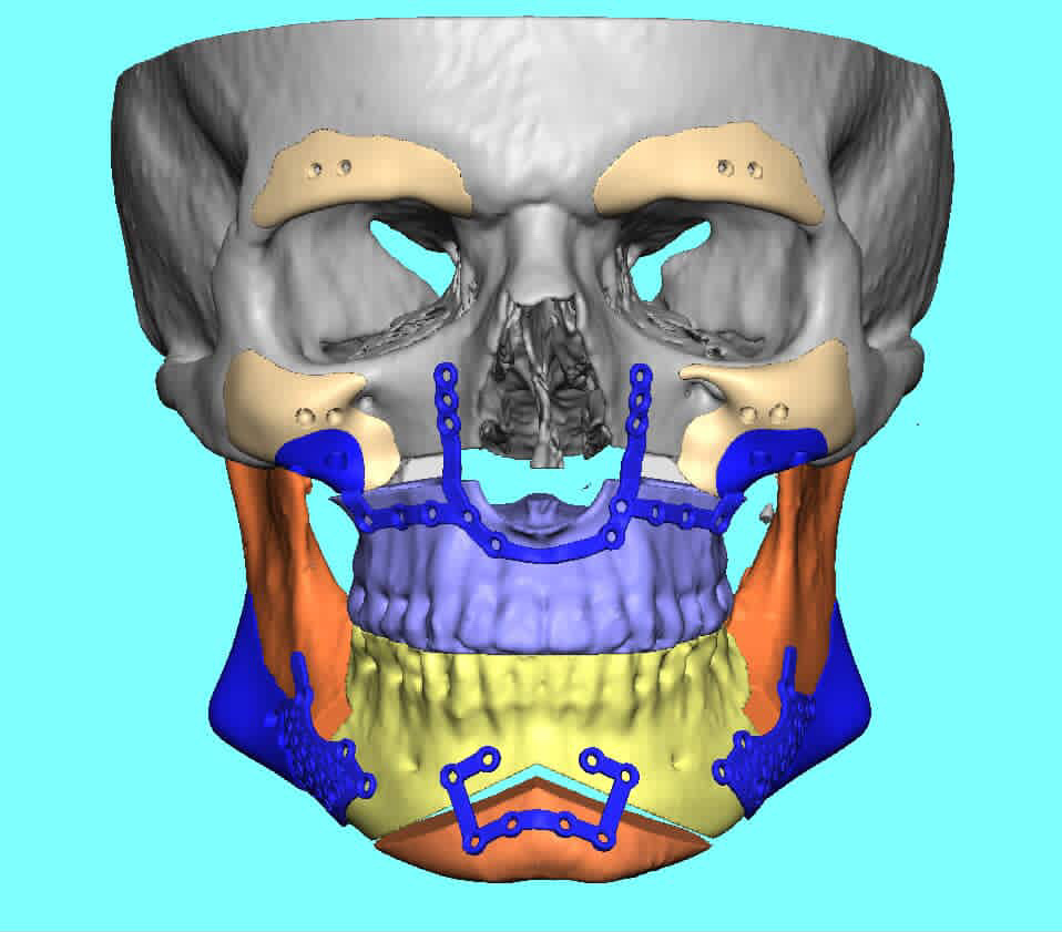 3B5BCCF6 50AF 4C21 9C65 BCE462749761